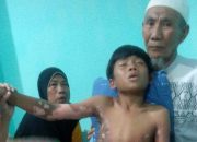 Asik Main Layangan, Anak Asal Lombok Timur Tersengat Aliran Listrik